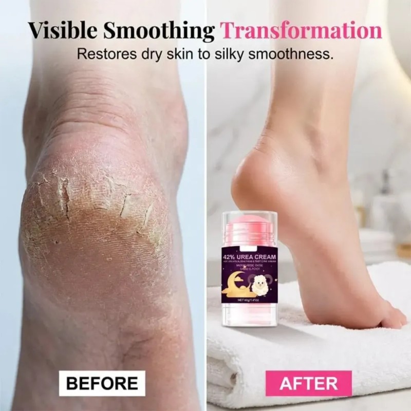 Crema Reparadora De Talones Con Ácido Salicílico, Barra