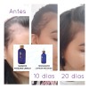 Shampoo Anticaida Para El Cabello Terramiracle Terramar