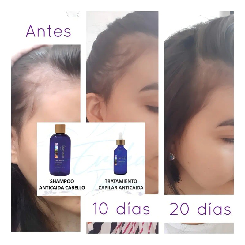 Shampoo Anticaida Para El Cabello Terramiracle Terramar