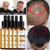 5X Batana Oil Serum Hair Growth For Healthier Thicker&Stronger Fuller