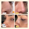 Pore Strips, Deep Cleansing Pore Strips, Blackhead Remover, Nose Plants