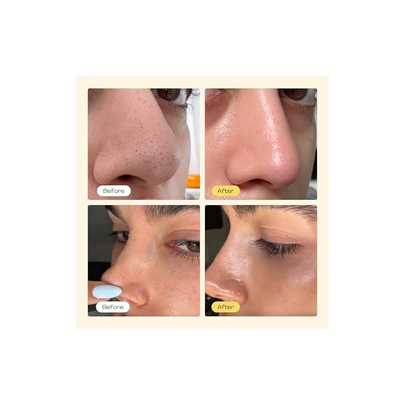 Pore Strips, Deep Cleansing Pore Strips, Blackhead Remover, Nose Plants