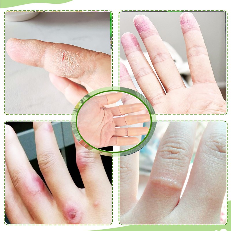 Gel Finger Cots,20 Pcs Silicone Finger Protectors Covers,Finger Caps Finger