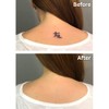 Tattoo Cover Up Makeup, Bruise Concealer, Waterproof, Smudge proof, 3