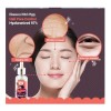 Sérum Hell Pore Control Elizavecca Witch Piggy para todo tipo