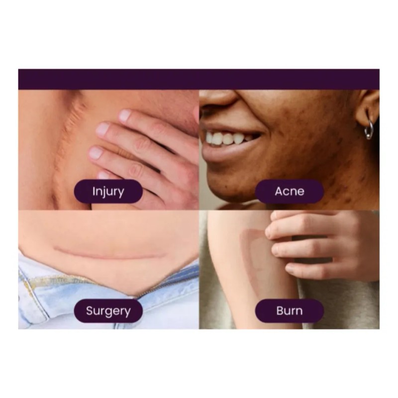 Mederma Gel Proactivo Reductor De Cicatrices 2pack 20g C/u Todo