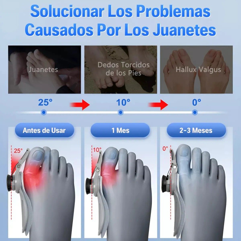 Corrector De Juanetes Ajustable Férula Único Dedo Del Pie