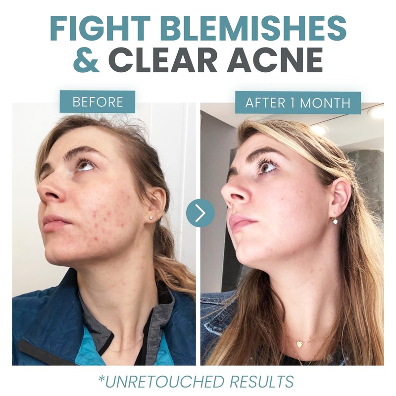 Eva Naturals Vitamin C Serum for Face - Vitamin C