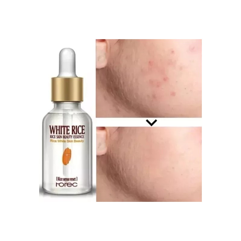 VC Ácido Hialuronico + Suero Serum De Arroz + Suero
