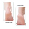 Callus Remover for Feet Dead Skin Scrubber Foot Scrub in