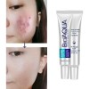 Bioaqua Acne Cream Reduce Cicatrices Poros Grasa Cuidado Continuo