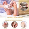 40 Pcs Toe Protector