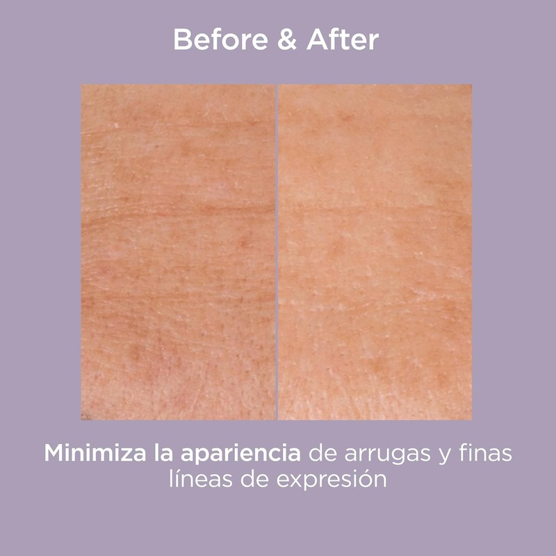 ISDIN ISDINCEUTICS Glicoisdin 25 Intense, Gel Facial Efecto Peeling con