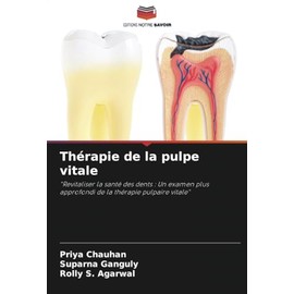 Thérapie de la pulpe vitale: "Revitaliser la santé des dents : Un examen plus approfondi de la thérapie pulpaire vitale" (French Edition)