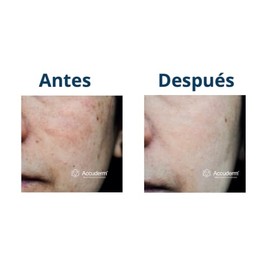 Suero Despigmentante Regulador 30ml - Sérum Facial Aclarante y Unificador del Tono de la Piel - Tratamiento Antimanchas para Melasma y Efélides con Ni