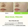 KLAVUU Gel Exfoliante Facial 80ml Exfoliación Suave y Piel Radiante