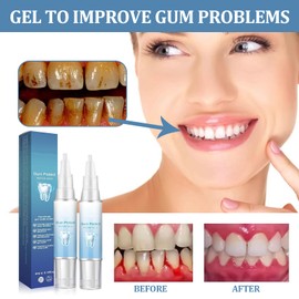 Gum Shield Therapy Gel,2Pack Neslemy™ Gum Therapy Gel Gum Treatment Gel Teeth Whitening Essence Pen Teeth Whitening Gel Teeth Whitening Toothpaste Enhances Overall Gum Health