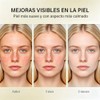 Crema Ácido Azelaico 50g