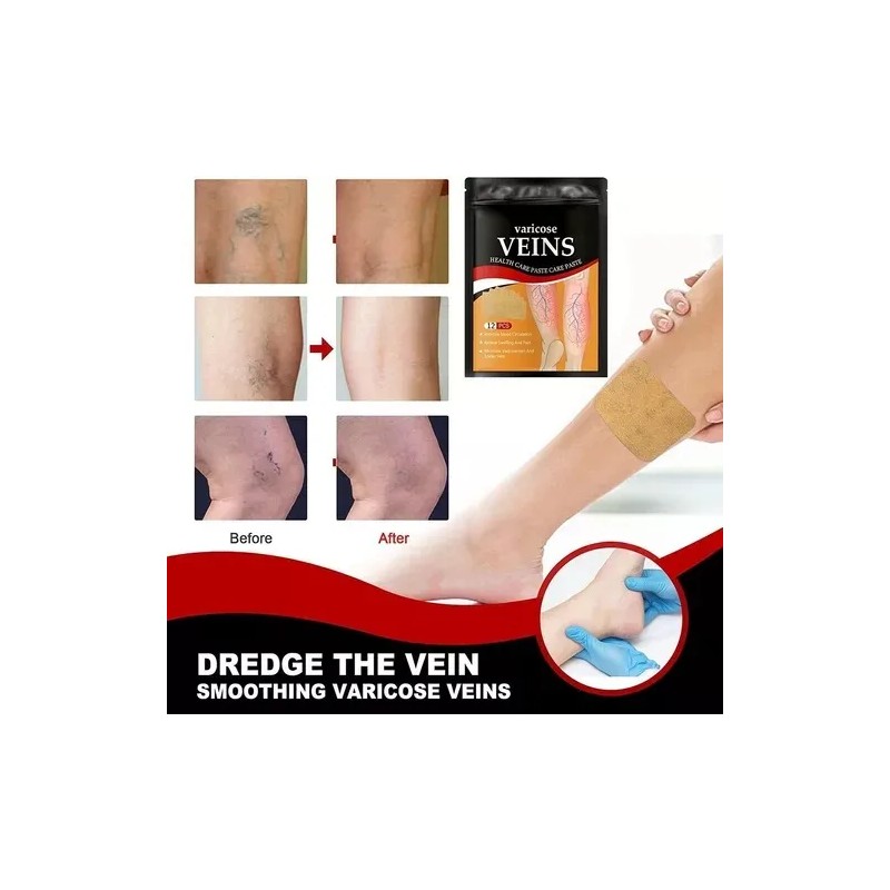 Parches Para Aliviar Las Venas Varicosas,36 Parches Por Pack Neutra