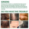 4pcs Ginseng Hair Regeneration Spray Moisturizing Tough Root Hair Regrowth