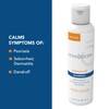 Kenkoderm Psoriasis Shampoo - 3 Percent Salicylic Acid Formula, Anti-Dandruff
