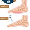 SULPO 3/4 Heel Spur Insoles, Heel Pads, Heel Protection, Heel