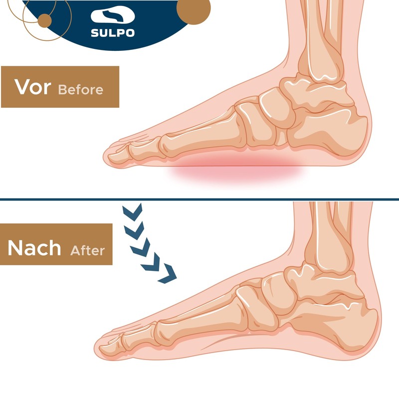 SULPO 3/4 Heel Spur Insoles, Heel Pads, Heel Protection, Heel