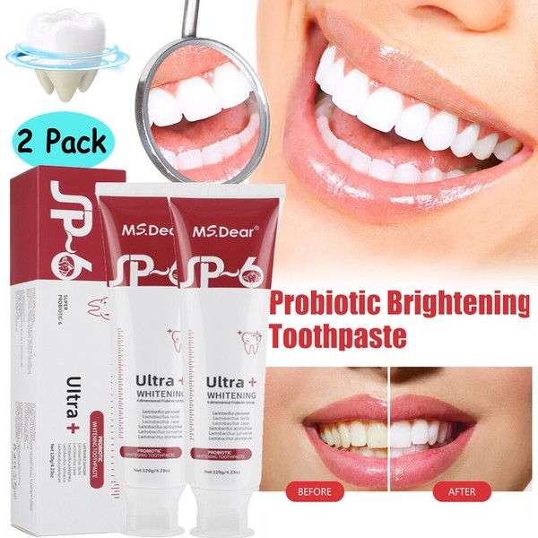 MS.Dear 2PCS Super Probiotic SP-6 Toothpaste, Probiotics Bright White Toothpaste,