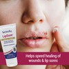 TriDerma LipSore Healing Cream, FSA Eligible, Calendula, AP4 Aloe Vera