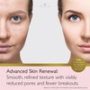 Revitale Advanced Salicylic Acid Cream for Face & Body 80g