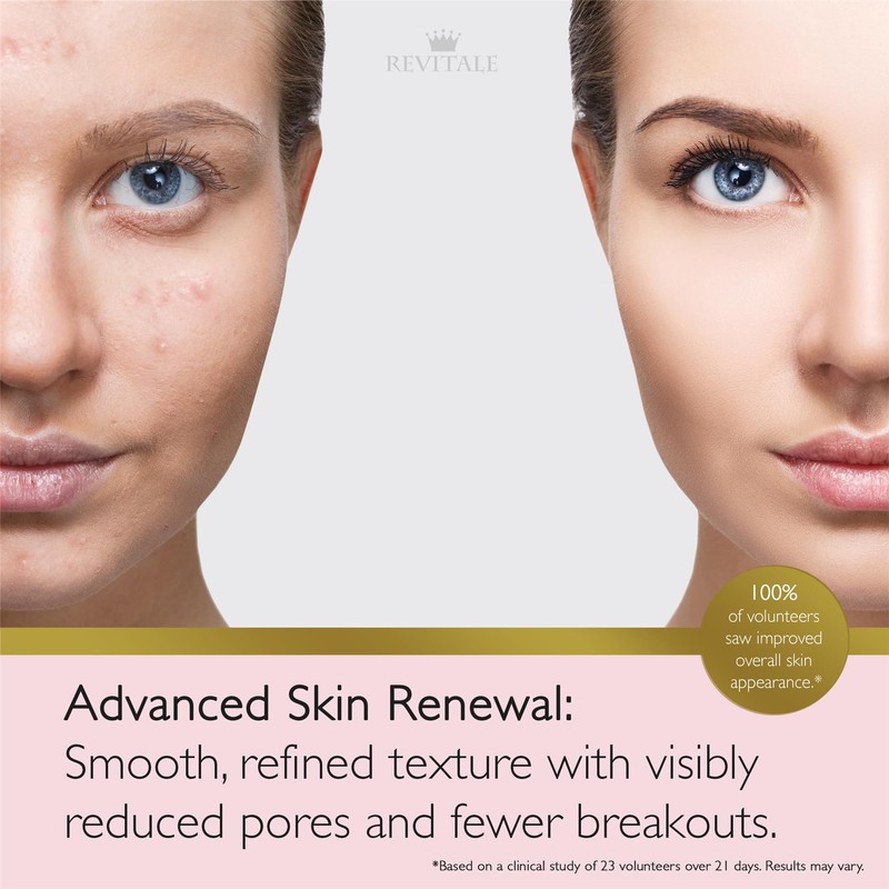 Revitale Advanced Salicylic Acid Cream for Face & Body 80g