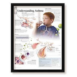 Understanding Arthritis Framed Medical Educational Poster Informational Diagram Doctors Office School Classroom 22x28 Inches