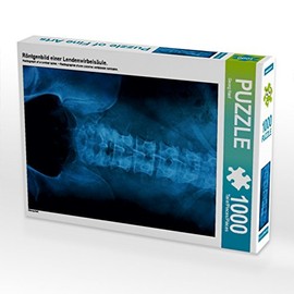 CALVENDO Puzzle X-ray image of a lumbar spine. 1000 pieces, size 48 x 64 cm, photo puzzle picture of Georg Hanf