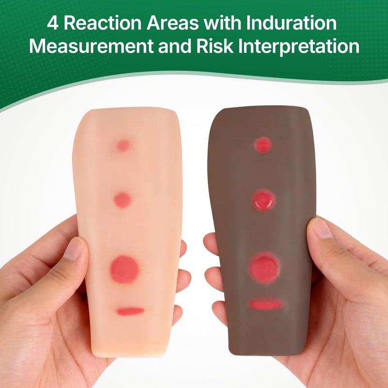 Ultrassist Tuberculosis(TB) Test Palpable Arm Set - Realistic Dual-Tone Training