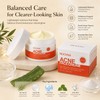 Herbal Face Cream for Blemish-Prone Skin – Oil-Control Moisturizer for