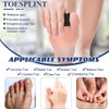 AFCJLTO Toe Splint for Correction of Hammer, Claw, Curved and