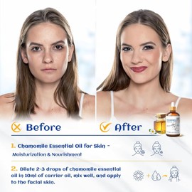 HIQILI 100ML Chamomile Essential Oil, Pure & Natural Chamomile Oil for Diffueser, Skin, Soap, Shampoo - 3.38 Fl Oz