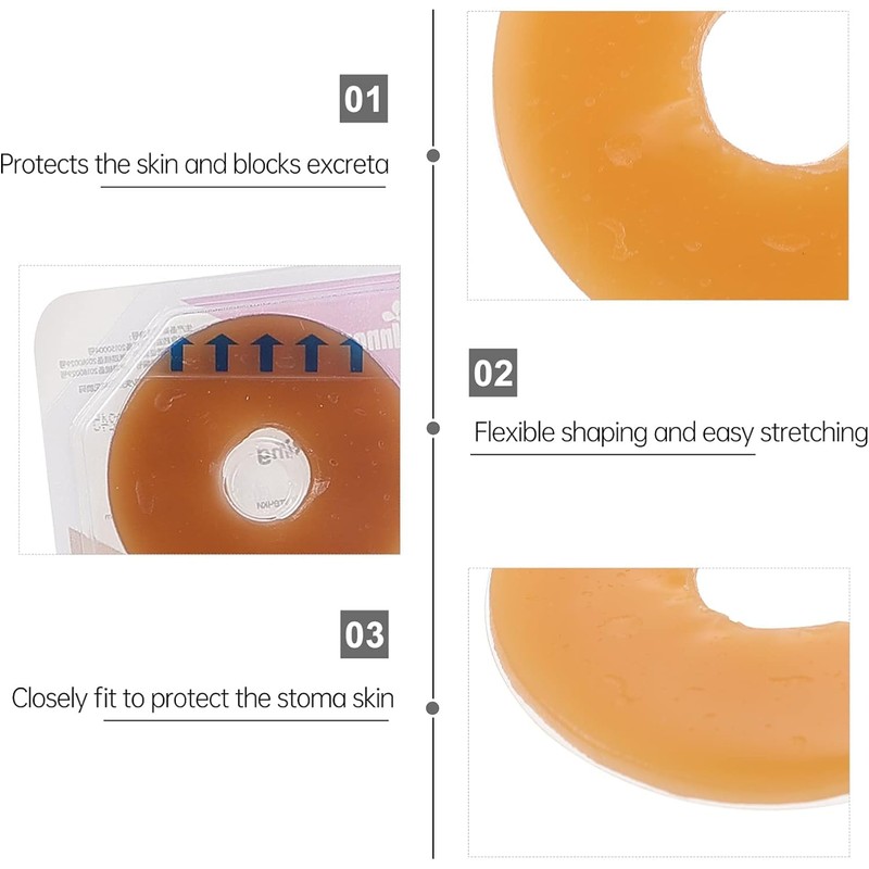 N 10Pcs Ostomy Barrier Rings Ostomy Barrier Tape Stoma Skin