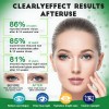 Suplemento Nutricional Gwynne Luteína Zinc Vitaminas Salud Macular Ojo Seco