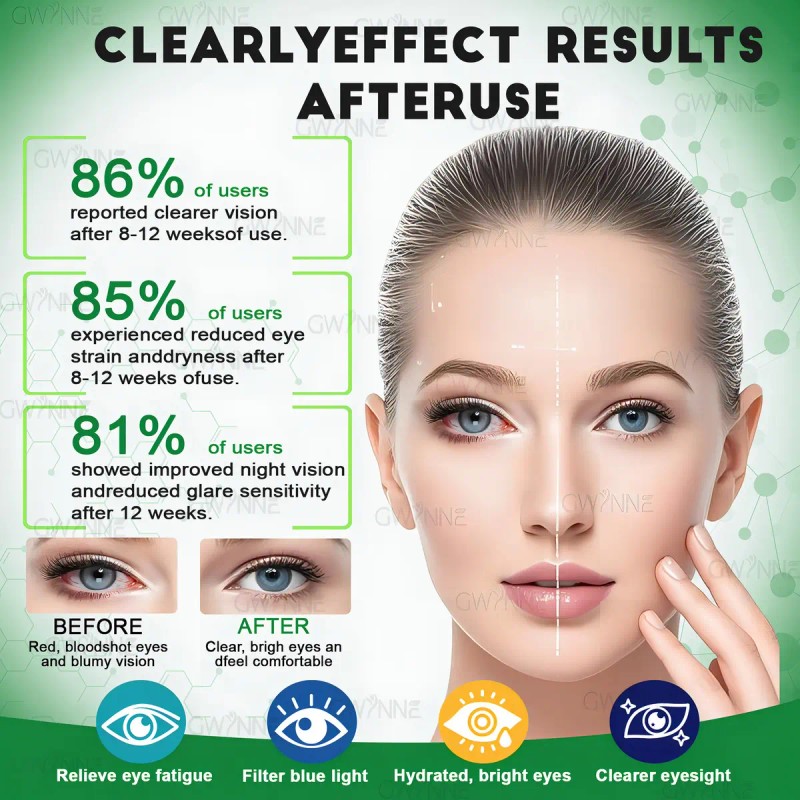 Suplemento Nutricional Gwynne Luteína Zinc Vitaminas Salud Macular Ojo Seco