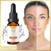 Bioaqua Serum Vitamina C Aclara Desmancha Hidrata Facial