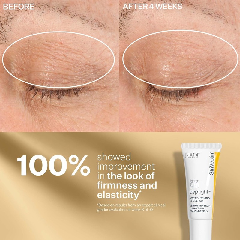 StriVectin Tightening and Lifting Peptide Face Lift Serum and Whitening