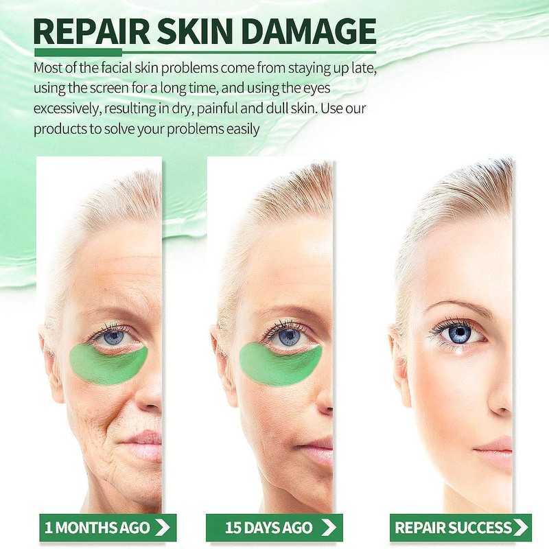 YiJiaBa Seaweed Under Eye Masks, Moisturizing, Nourishing, Improving Dark Circles,