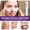 Azelaic Acid Cream