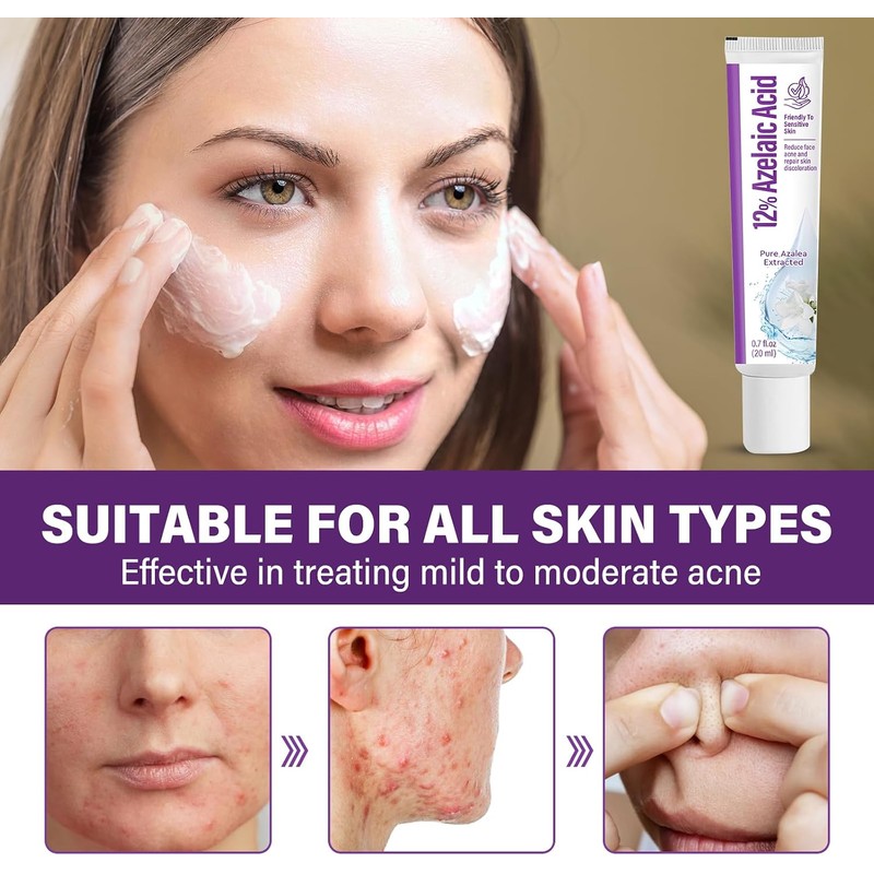 Azelaic Acid Cream