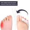 WMUVAZA Zehenspreizer Silikon, 10 Stück Zur Behandlung Von Hammerzehen Zehenspreizer