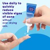 Clean & Clear Advantage Acne Spot Treatment, Unisex, 0.75 oz