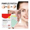 200 Parches Pegatinas Acn Estrellas Colores Pimple Patch Normal Danoche