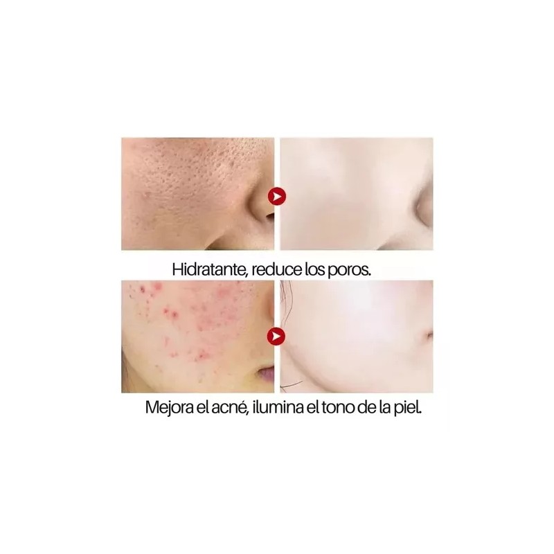 Mafab Dúo Rorec Reduce Poros Disminuye Ojeras Arrugas Hidratante