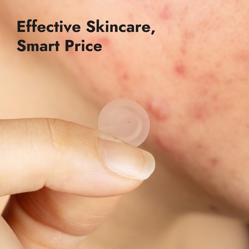 Epielle Over-Zit Acne Clear Patches 138 Count, Hydrocolloid Acne Pimple